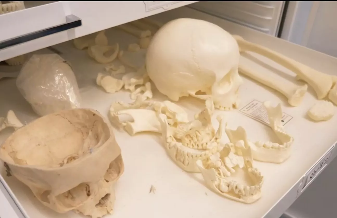 bones